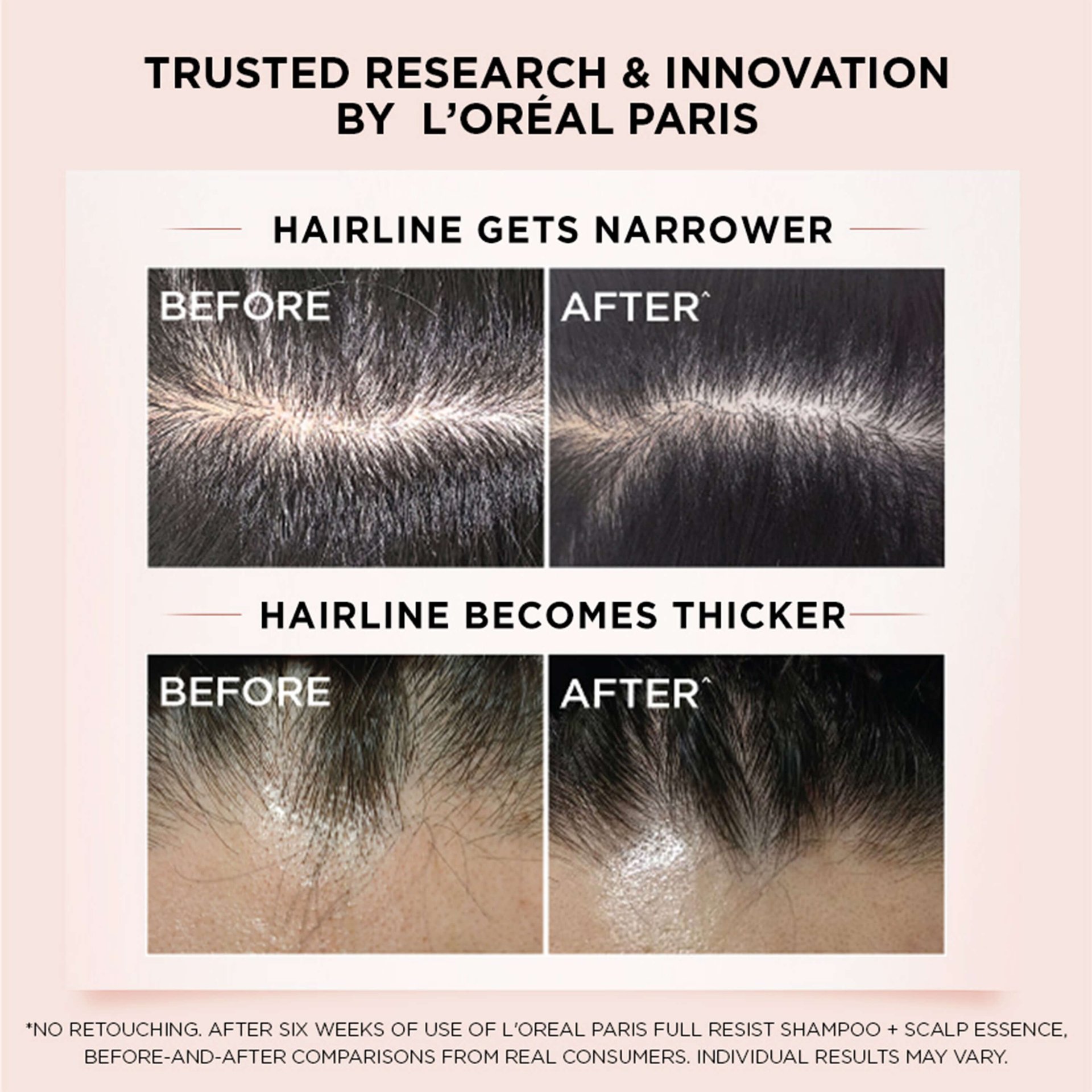 Full Resist Anti Hair Fall Scalp Essenc 3